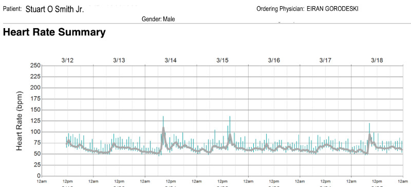 Long-Term Holter Study Summary. Enrollment Period: 3/12/2024 - 3/26/2024. Heart Rate Summary. Long-Term Holter Study Summary. Enrollment Period: 3/12/2024 - 3/26/2024. Heart Rate Summary.