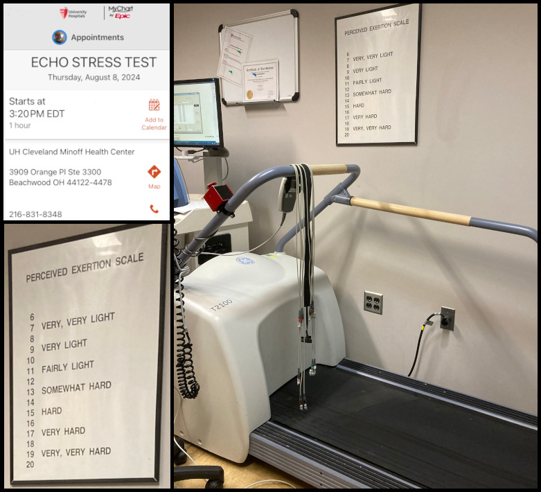 August 8, 2024, Echo Stress Test. August 8, 2024, Echo Stress Test.